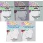 Neurologopedyczne studia przypadków. Pakiet (5 tomów)  1  